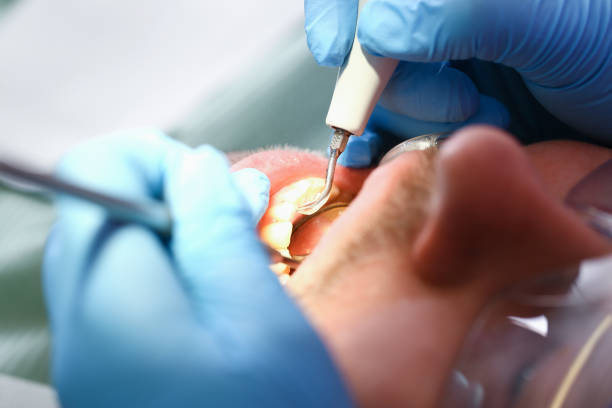 Best Broken or Cracked Tooth Emergency Dentist in Honeyville, UT